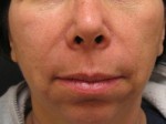 Cosmetic Injectables