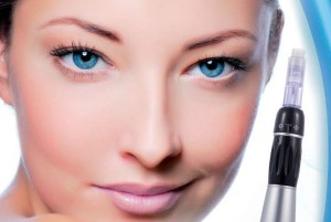 Microneedling Microneedling Procedure Newnan Peachtree City