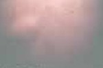LIPOMA LIPOMA