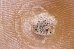 WART WART