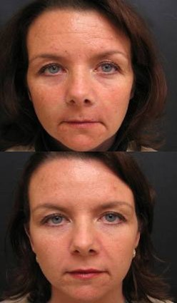 Before & After Before & After