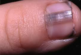 Nails... how to protect and condition