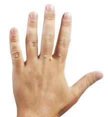 Warts Warts