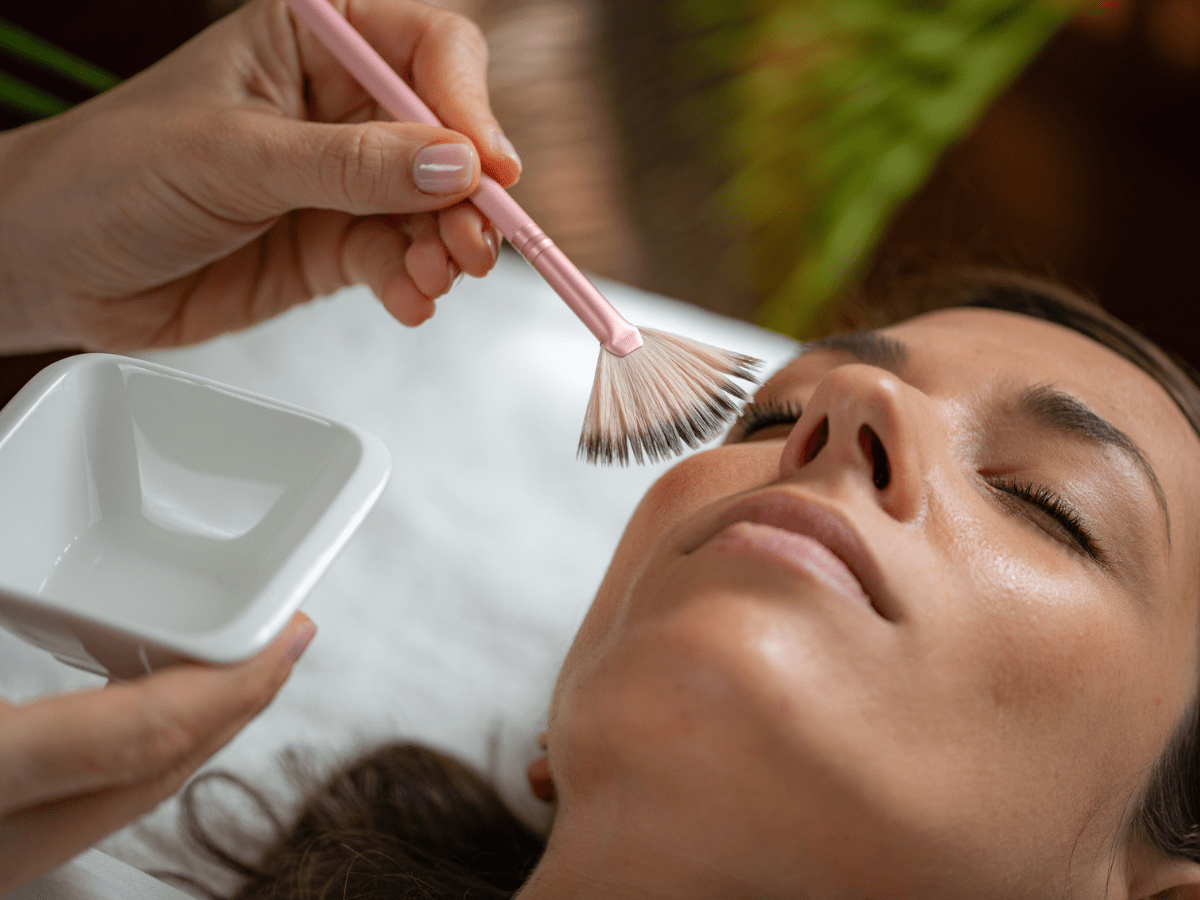 chemical peel treatment