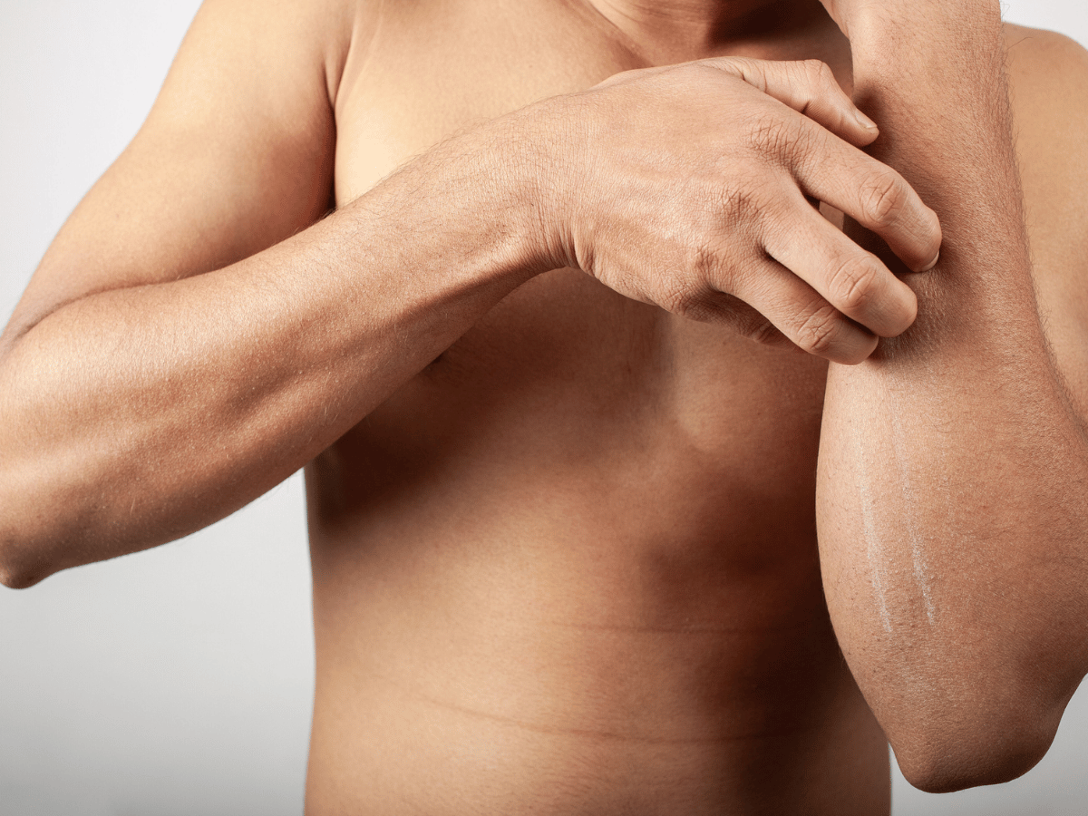 itching rashes on arm