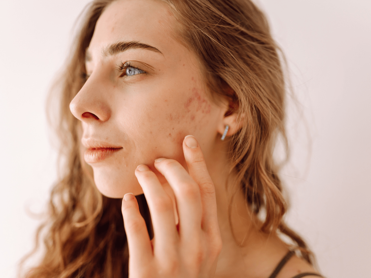 scars on females face